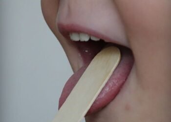 Специалист УНГ към МБАЛ “Св. Анна” коментира на какво се дължи кървенето от носа при децата и кога трябва да бъде махната третата сливица (ВИДЕО)