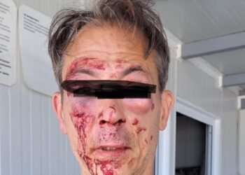 Французин и българин се сбиха в Поморие заради чадър