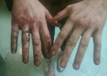 Агресивни питбули без каишки нападнаха украинец във Варна, убиха домашния му любимец! Собственикът на зверовете не реагира!