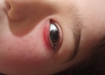 Момиченце пострада след жесток побой от съученик в Провадия