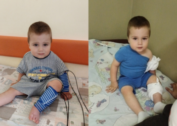 Нека помогнем на малкия Крис да расте без болка (ВИДЕО)